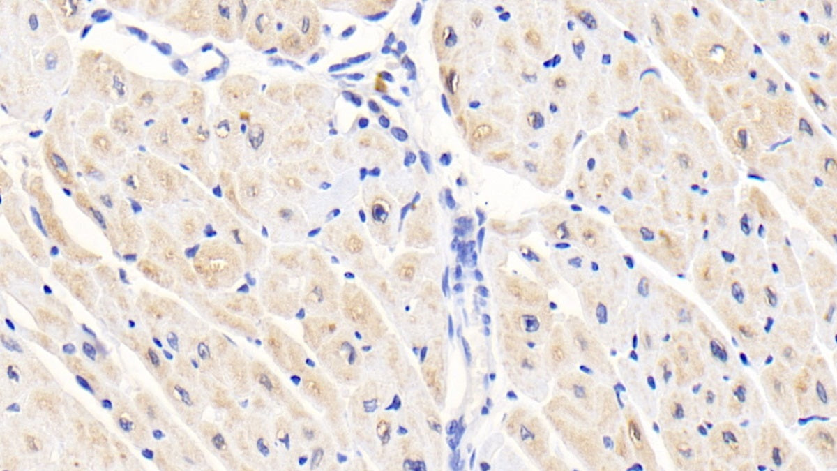 Activin A Receptor Type I (ACVR1) Polyclonal Antibody - image 4