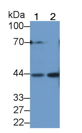 DAB staining on IHC-P; Samples: Human Kidney Tissue; Primary Ab: 20µg/ml Rabbit Anti-Human KLK1 Antibody Second Ab: 2µg/mL HRP-Linked Caprine Anti-Rabbit IgG Polyclonal Antibody
