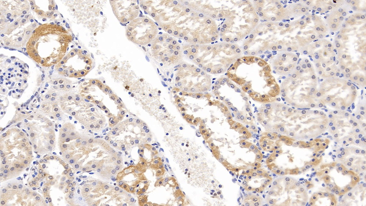 DAB staining on fromalin fixed paraffin-embedded Kidney tissue)