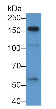 Alpha-2-Macroglobulin Like Protein 1 (a2ML1) Polyclonal Antibody - image 3