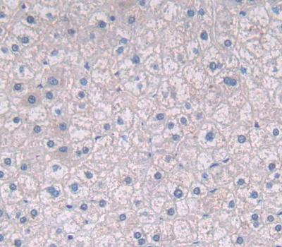 ATP Binding Cassette Transporter G2 (ABCG2) Polyclonal Antibody - image 3
