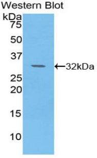 Pyruvate Dehydrogenase Kinase 4 (PDK4) Polyclonal Antibody - image 2