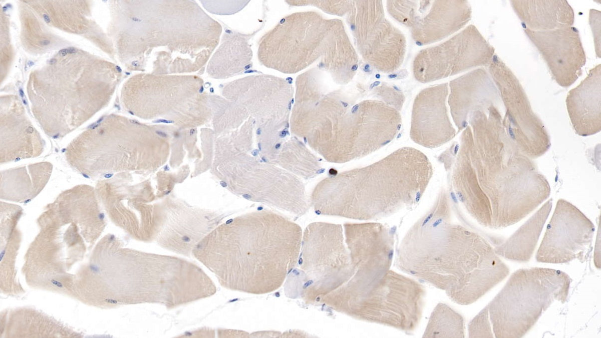 DABstainingonIHC-P.Samples:HumanTissue)