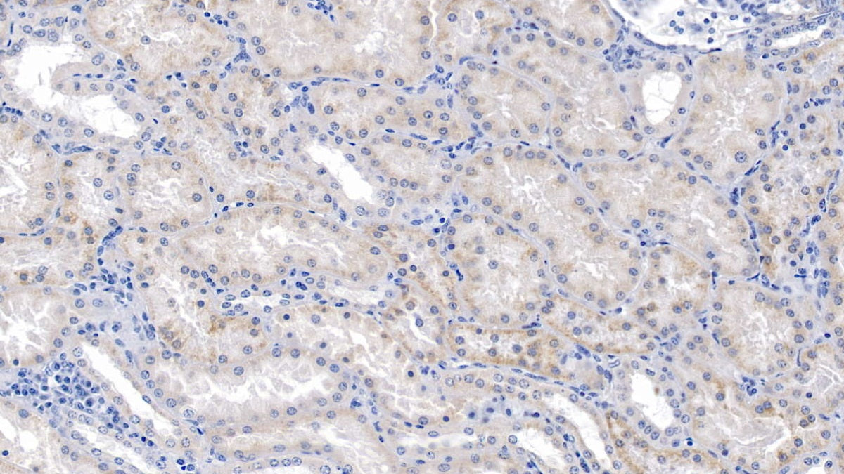 Pyruvate Dehydrogenase Kinase 4 (PDK4) Polyclonal Antibody - image 4