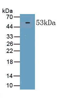 Procollagen I N-Terminal Propeptide (PINP) Polyclonal Antibody - image 2