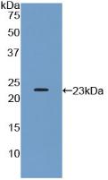 Protein Tyrosine Phosphatase Receptor Type N (PTPRN) Polyclonal Antibody - image 3