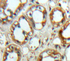Signal Regulatory Protein Alpha (SIRPa) Polyclonal Antibody - image 4