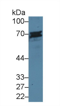 Western Blot; Sample: Recombinant protein.