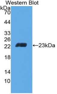 Used in DAB staining on fromalin fixed paraffin-embedded Spleen tissue