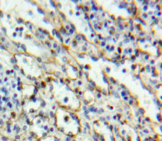 Cluster Of Differentiation 6 (CD6) Polyclonal Antibody - image 4