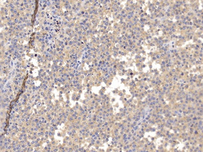 Cluster Of Differentiation 6 (CD6) Polyclonal Antibody - image 3