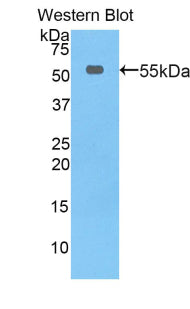 Thymidine Phosphorylase (TP) Polyclonal Antibody - image 2