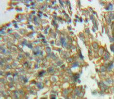 Signal Regulatory Protein Gamma (SIRPg) Polyclonal Antibody - image 3