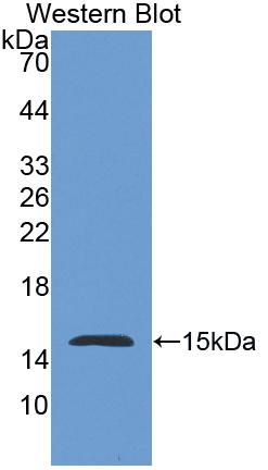 Nephrin (NPHN) Polyclonal Antibody - image 2