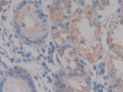 DAB staining on fromalin fixed paraffin-embedded Kidney tissue)