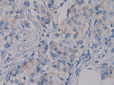 Nephrin (NPHN) Polyclonal Antibody - image 4