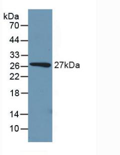 DAB staining on IHC-P; Samples: Mouse Kidney Tissue; Primary Ab: 30µg/ml Rabbit Anti-Mouse PCK1 Antibody Second Ab: 2µg/mL HRP-Linked Caprine Anti-Rabbit IgG Polyclonal Antibody
