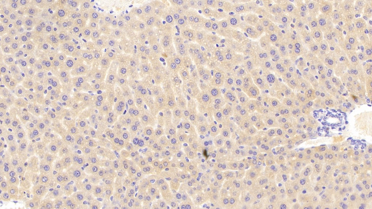 Phosphoenolpyruvate Carboxykinase 1, Soluble (PCK1) Polyclonal Antibody - image 5