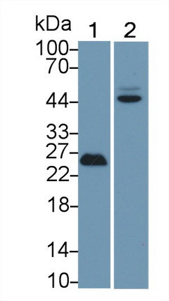 FITC staining on IF; Samples: Human HepG2 cell;  Primary Ab: 20μg/ml Rabbit Anti-Human TP53 Antibody Second Ab: 1.5μg/ml FITC-Linked Caprine Anti-Rabbit IgG Polyclonal Antibody