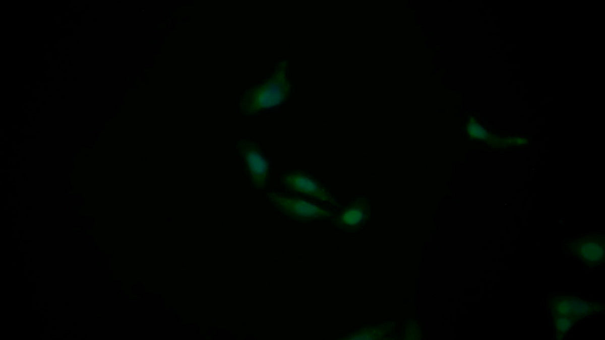 Tumor Protein p53 (P53) Polyclonal Antibody - image 4
