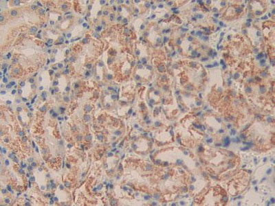 Dihydrolipoyl Dehydrogenase (DLD) Polyclonal Antibody - image 5