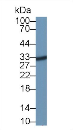Acid Phosphatase 5, Tartrate Resistant (ACP5) Polyclonal Antibody - image 2