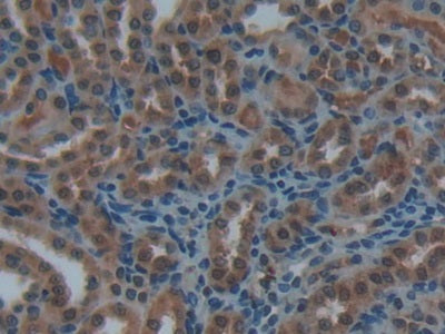 DAB staining on fromalin fixed paraffin- embedded kidney tissue)