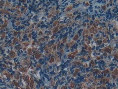 Acid Phosphatase 5, Tartrate Resistant (ACP5) Polyclonal Antibody - image 4
