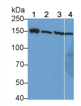 Insulin Receptor (Anti-INSR) Polyclonal Antibody - image 2