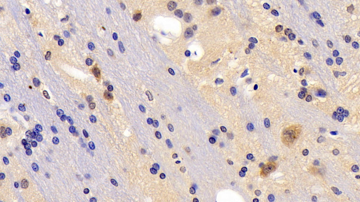 DABstainingonIHC-P.Samples:RatTissue)