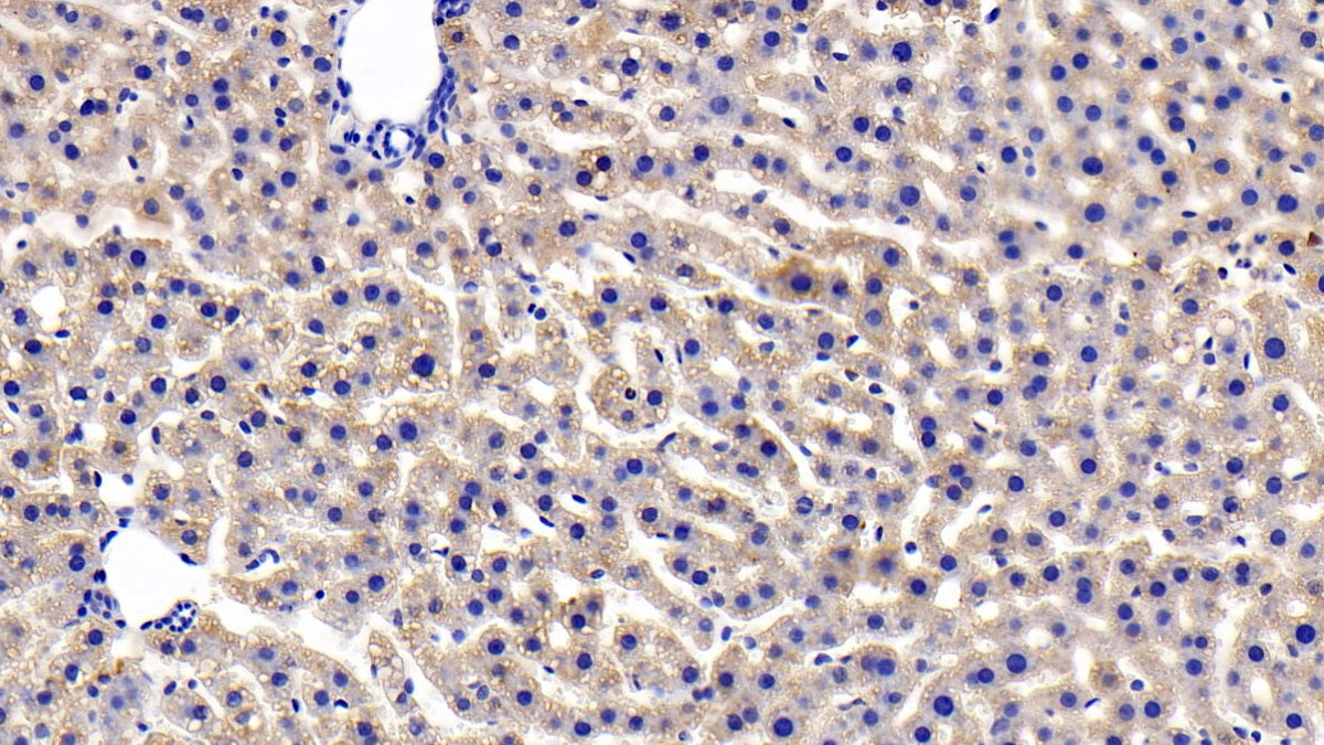 Insulin Receptor (Anti-INSR) Polyclonal Antibody - image 4