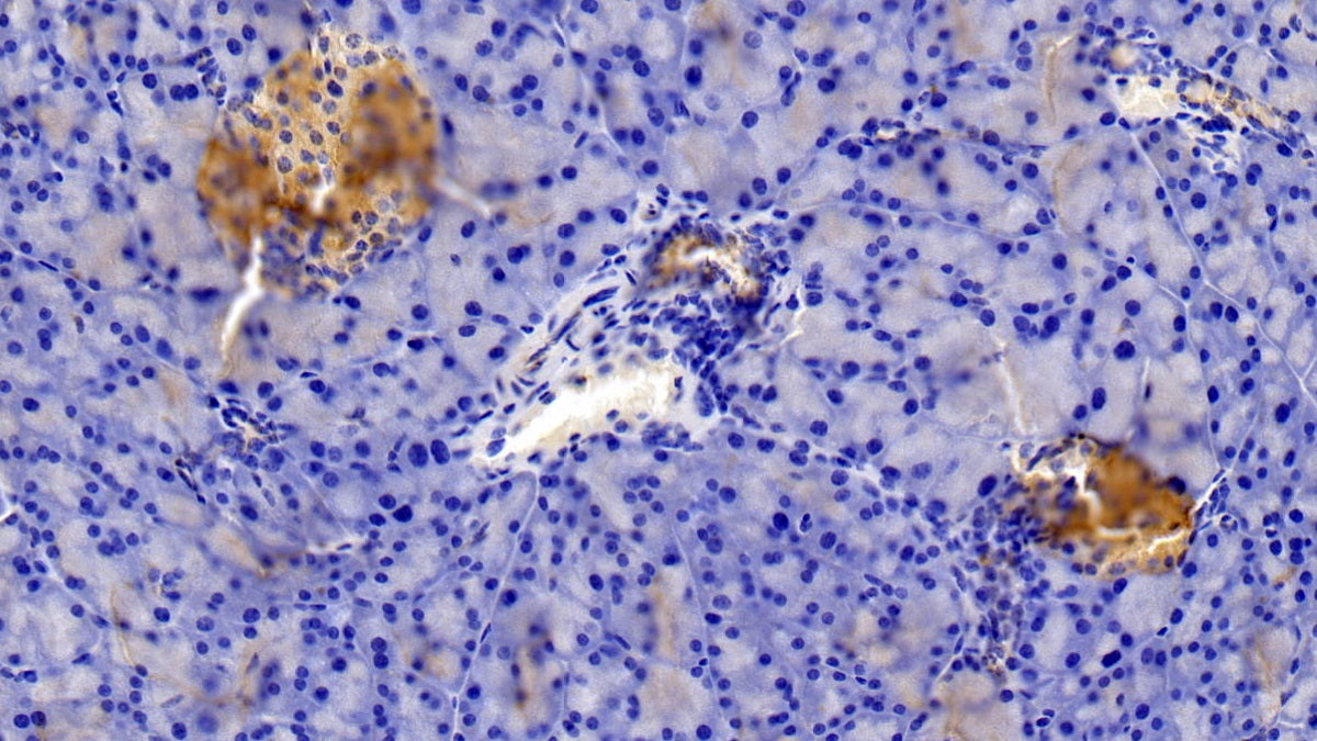 DABstainingonIHC-P.Samples:MouseTissue)