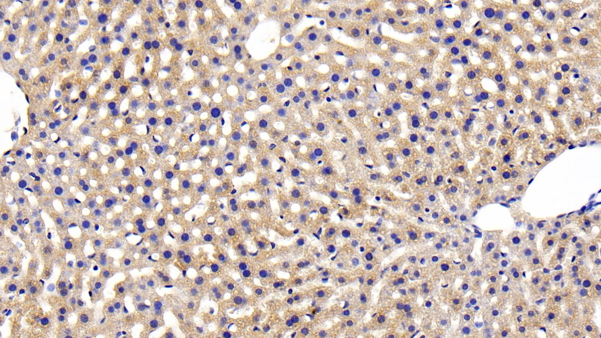 Insulin Receptor (Anti-INSR) Polyclonal Antibody - image 4