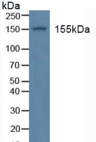 Figure. Western Blot; Sample: Recombinant ISR, Human.