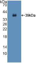 DAB staining on IHC-P; Samples: Human Liver Tissue; Primary Ab: 20μg/ml Rabbit Anti-Human ISR Antibody Second Ab: 2µg/mL HRP-Linked Caprine Anti-Rabbit IgG Polyclonal Antibody