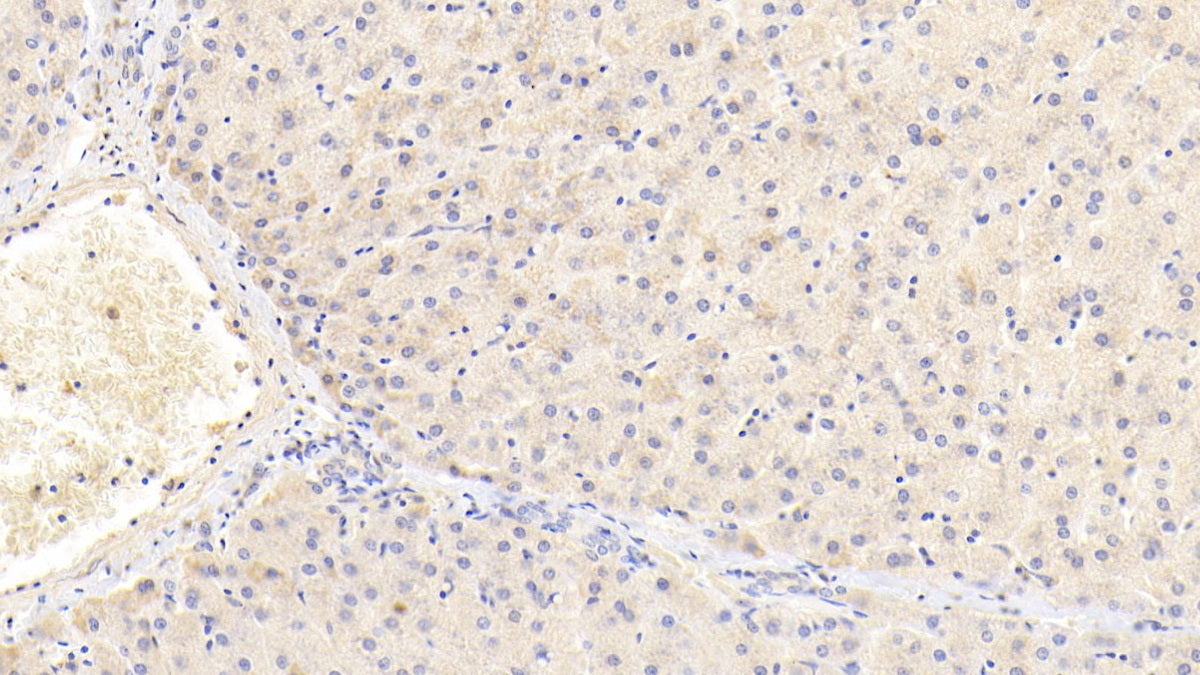 DAB staining on fromalin fixed paraffin-embedded Liver tissue)