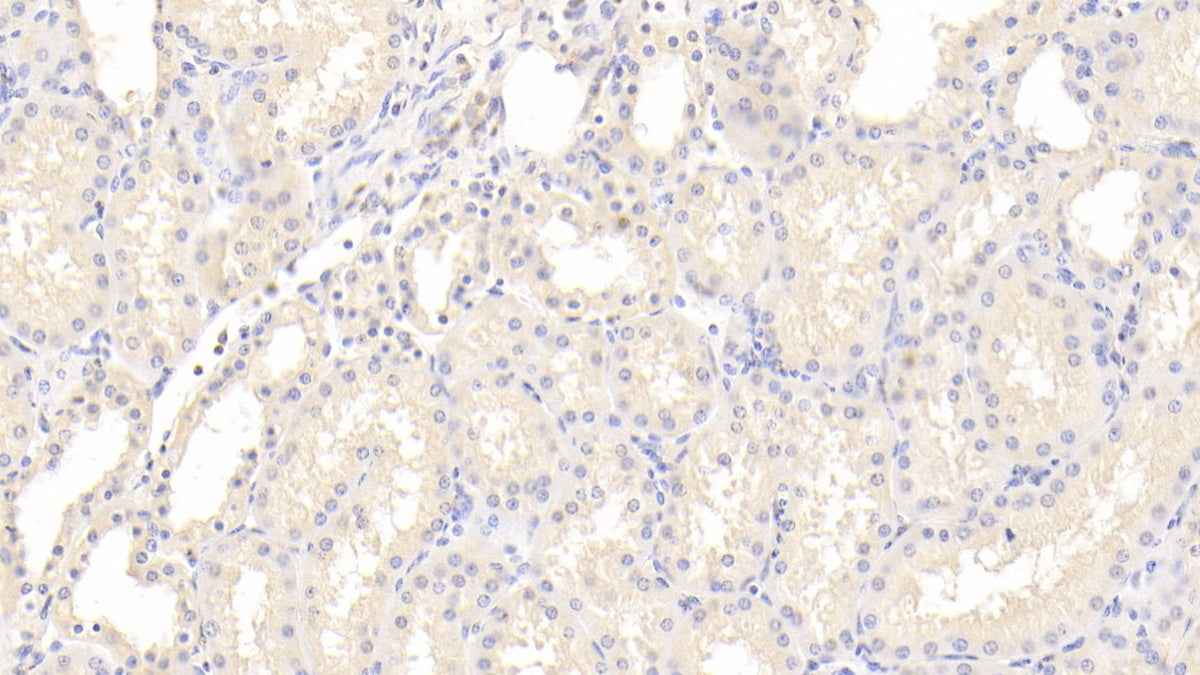 Insulin Receptor (Anti-INSR) Polyclonal Antibody - image 5