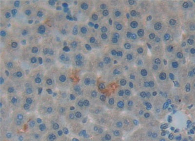 DAB staining on IHC-P; Samples: Rat Kidney Tissue.