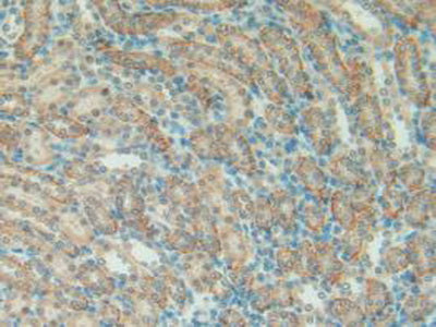 Pulmonary Surfactant Associated Protein A1 (SFTPA1) Polyclonal Antibody - image 5