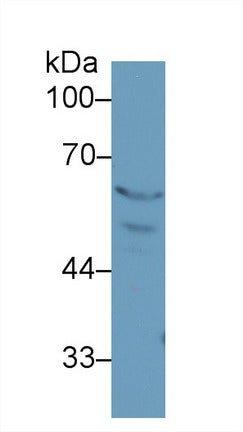 Western Blot; Sample: Recombinant protein.