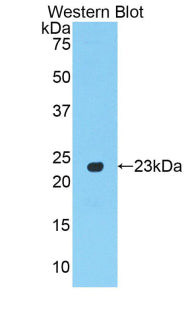 Peroxisome Proliferator Activated Receptor Gamma (PPARg) Polyclonal Antibody - image 3