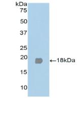 DAB staining on IHC-P; Samples: Human Cardiac Muscle Tissue;  Primary Ab: 20μg/ml Rabbit Anti-Human PPARg Antibody Second Ab: 2µg/mL HRP-Linked Caprine Anti-Rabbit IgG Polyclonal Antibody