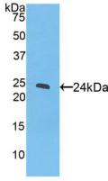 Peroxisome Proliferator Activated Receptor Gamma (PPARg) Polyclonal Antibody - image 2