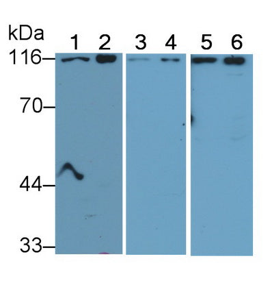 DAB staining on IHC-P; Samples: Mouse Kidney Tissue; Primary Ab: 30ug/ml Rabbit Anti-Mouse DPP4 Antibody Second Ab: 2µg/mL HRP-Linked Caprine Anti-Rabbit IgG Polyclonal Antibody