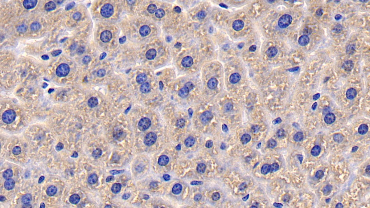 Cluster Of Differentiation 26 (CD26) Polyclonal Antibody - image 5