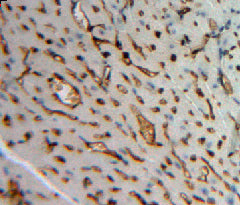 Angiopoietin-3 (ANG-3) Polyclonal Antibody - image 3