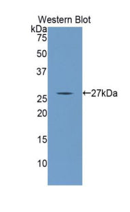Western Blot; Sample: Lane1: Human Serum; Lane2: 293T cell lysate; Primary Ab: 1µg/ml Rabbit Anti-Human ANGPTL1 Antibody; Second Ab: 0.2µg/mL HRP-Linked Caprine Anti-Rabbit IgG Polyclonal Antibody;
