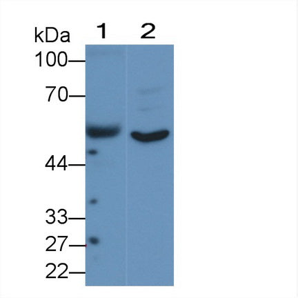 DAB staining on IHC-P; Samples: Human Kidney Tissue;  Primary Ab: 20µg/ml   Rabbit Anti-Human ANGPTL1 Antibody Second Ab: 2µg/mL HRP-Linked Caprine Anti-Rabbit IgG Polyclonal Antibody