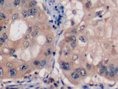 DAB staining on fromalin fixed paraffin-embedded Liver tissue)