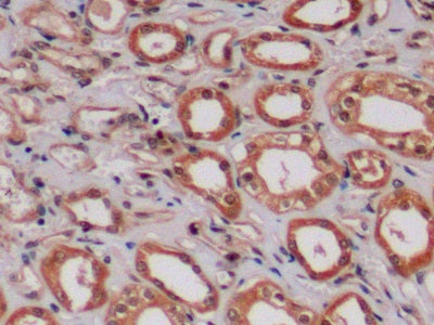 Anaplastic Lymphoma Kinase (ALK) Polyclonal Antibody - image 5